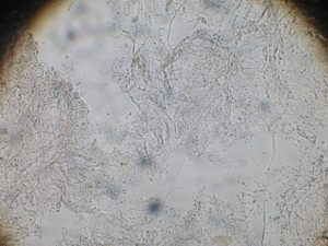 たむしの真菌　顕微鏡像