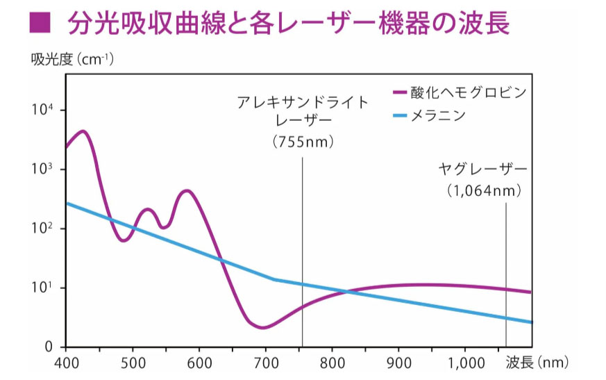 分光吸収曲線と各レーザー機器の波長