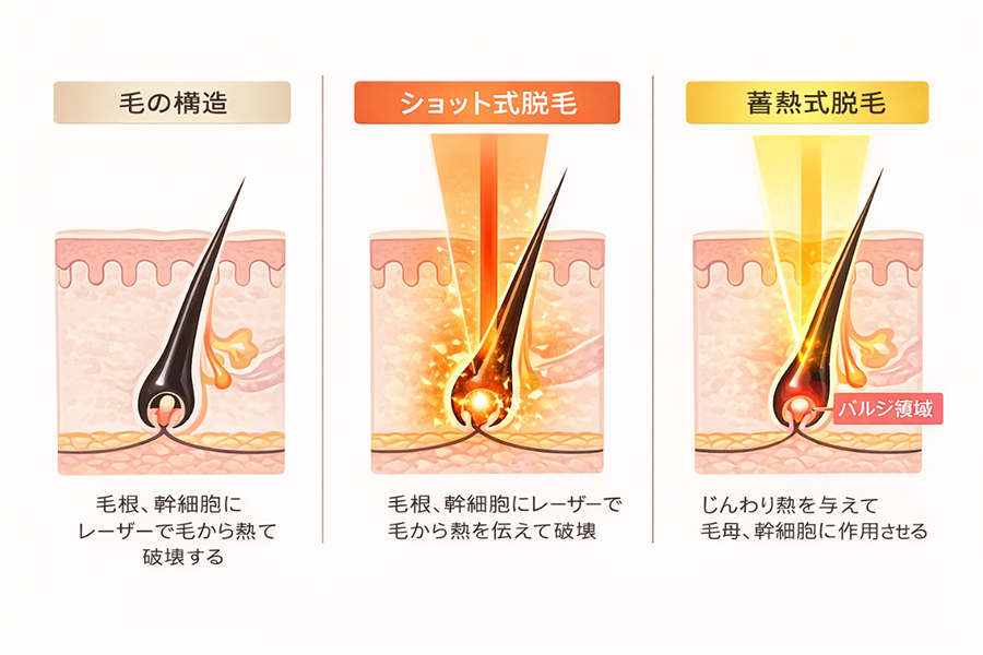 照射時に起きている4つのステップ